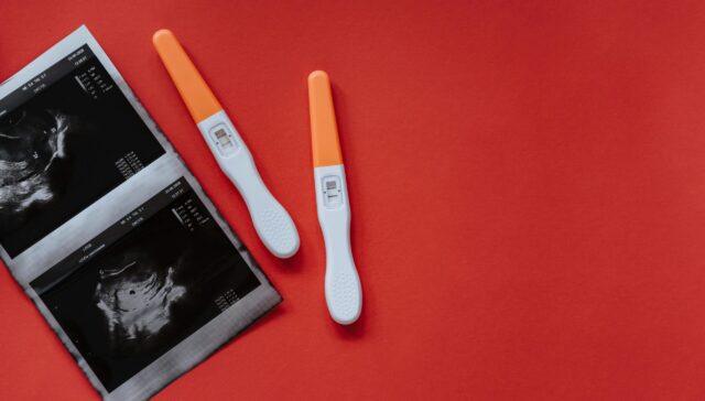So You're Pregnant. Now What